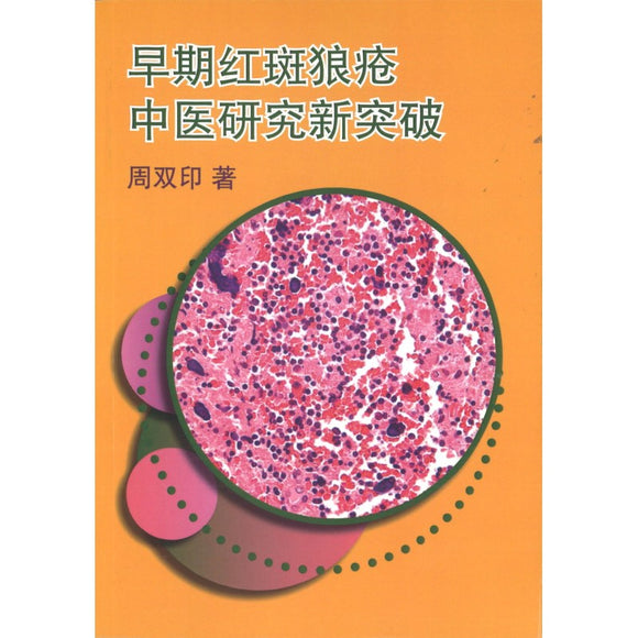 早期红斑狼疮中医研究新突破 9789811864599 | Singapore Chinese Bookstore | Maha Yu Yi Pte Ltd